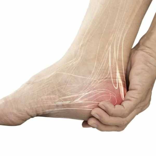 La tendinite du tendon d'Achille