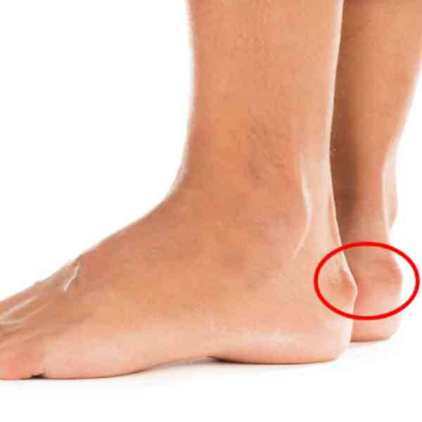 Chirurgien du sport Ajaccio Corse