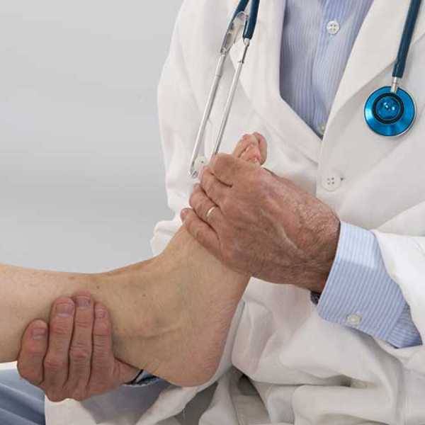 Déformation du pied