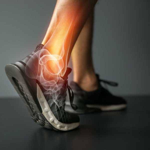 Entorse/fracture de cheville
