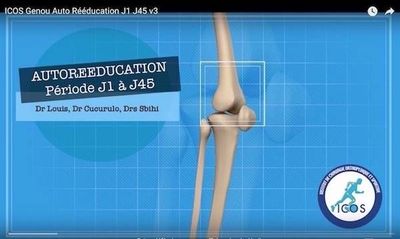 Notre zone d'activité pour ce service Opération pour problèmes de ménisque ou de tendon rotulien