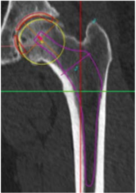 Notre zone d'activité pour ce service Soigner la rhizarthrose