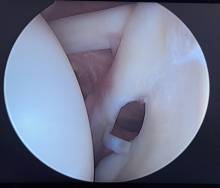 Notre zone d'activité pour ce service Opération hanche et épaule