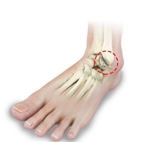 Notre zone d'activité pour ce service Chirurgien orthopédiste