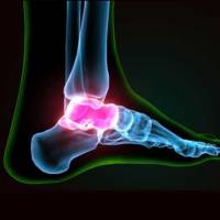 Notre zone d'activité pour ce service Chirurgien orthopédiste