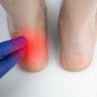 Notre zone d'activité pour ce service Opération du tendon d'Achille