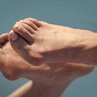 Notre zone d'activité pour ce service Se faire opérer d'un hallux valgus