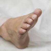 Notre zone d'activité pour ce service Opération pied et avant-pied