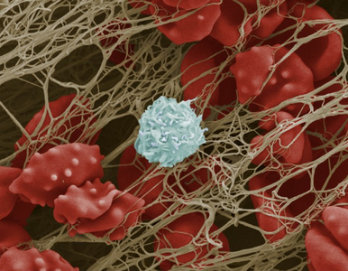 Notre zone d'activité pour ce service Soigner l'arthrose du genou avec l'injection d'acide hyaluronique