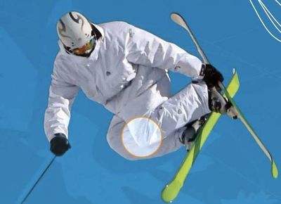 Notre zone d'activité pour ce service Opération pour entorse du genou ou de la cheville