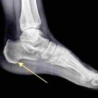 Notre zone d'activité pour ce service Chirurgie orthopédique assistée par l'intelligence artificielle