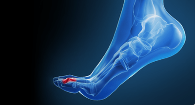 Notre zone d'activité pour ce service Opération hanche et épaule