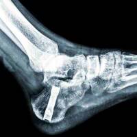 Nos prestations sur le secteur de Ajaccio Corse