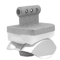 Notre zone d'activité pour ce service Institut de chirurgie pour arthrodèse de cheville