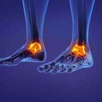 Notre zone d'activité pour ce service Chirurgien orthopédiste